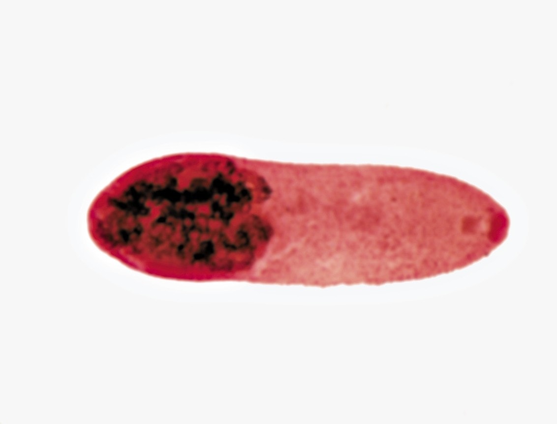 Heterophyes heterophyes ENCYKLOPEDIA PASOŻYTÓW